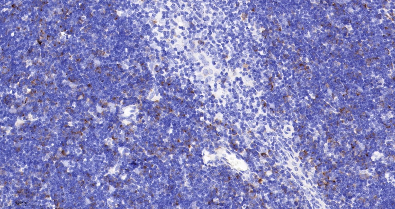 TACC3重组兔单抗