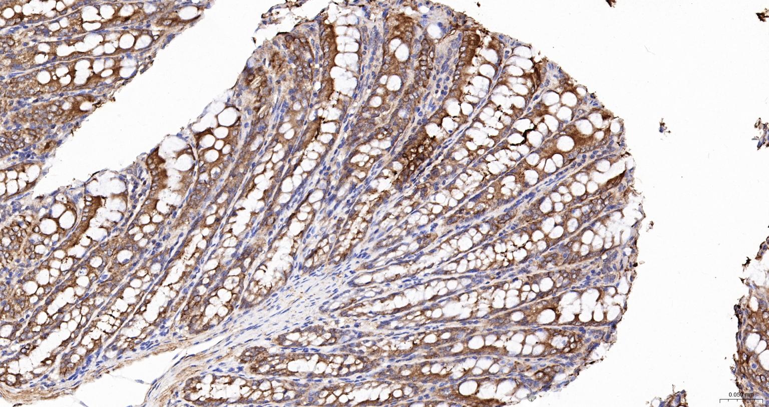 细胞角蛋白18抗体-bs-2043R