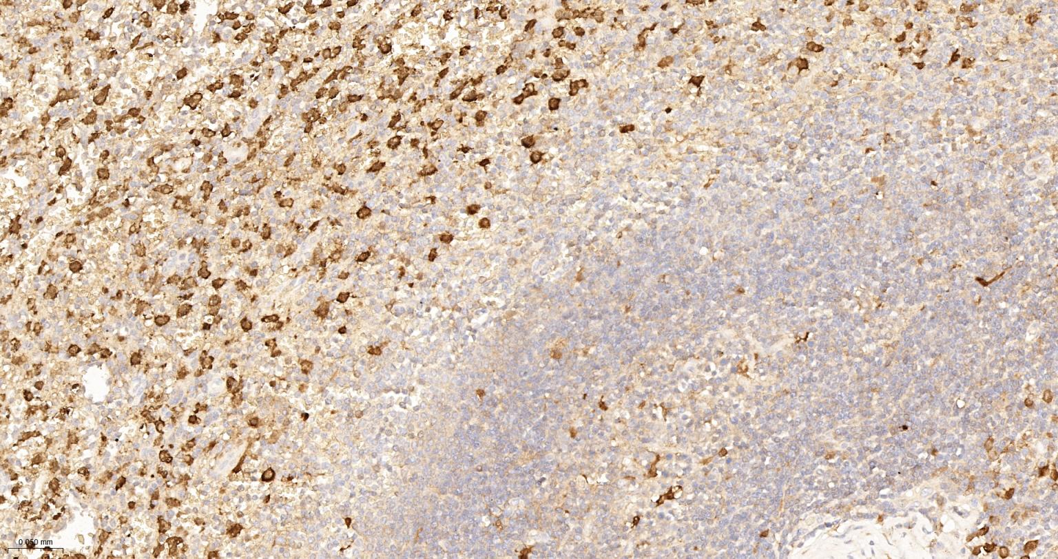 血红素氧合酶 1抗体