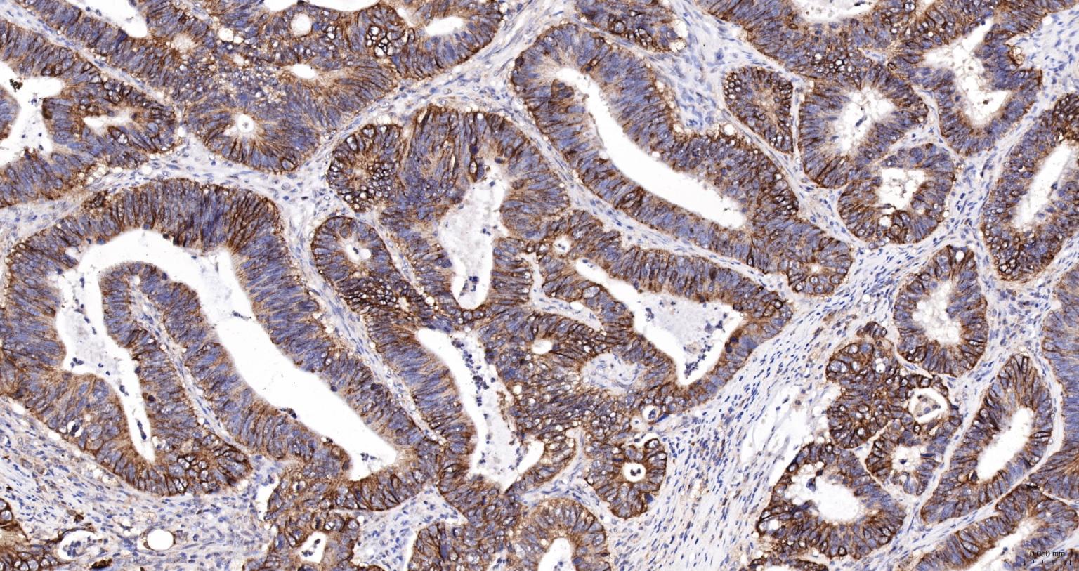 细胞角蛋白18抗体-bs-2043R