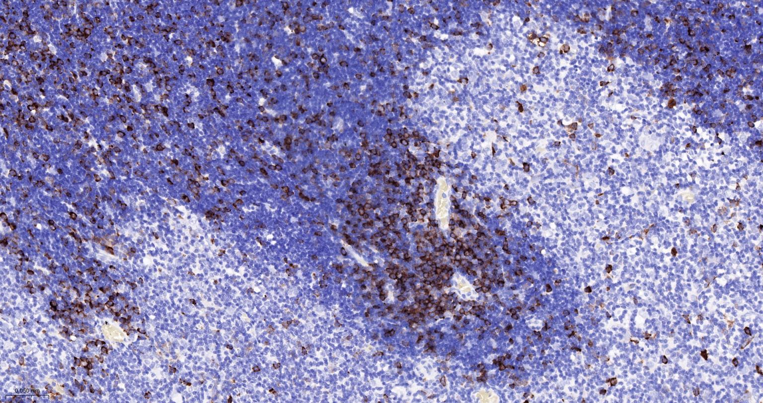 TACC3重组兔单抗