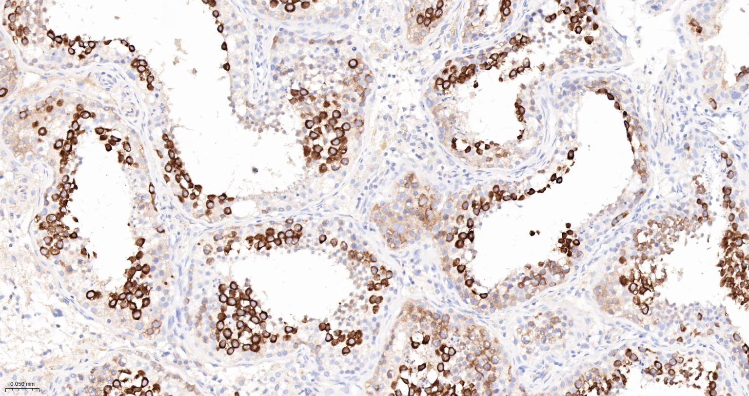 TACC3重组兔单抗