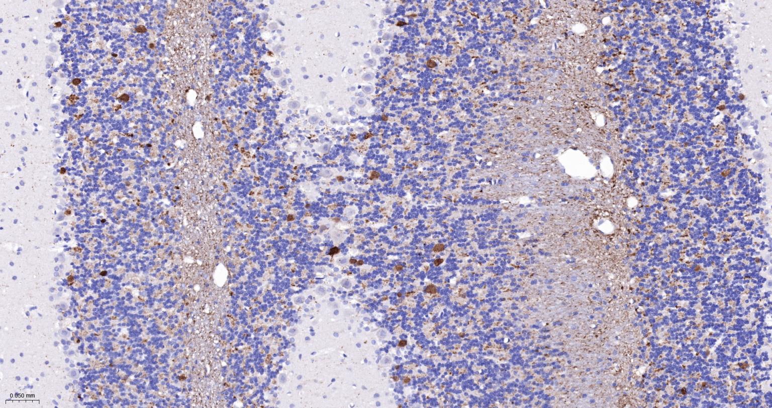 神经细胞胞浆蛋白9.5重组兔单抗