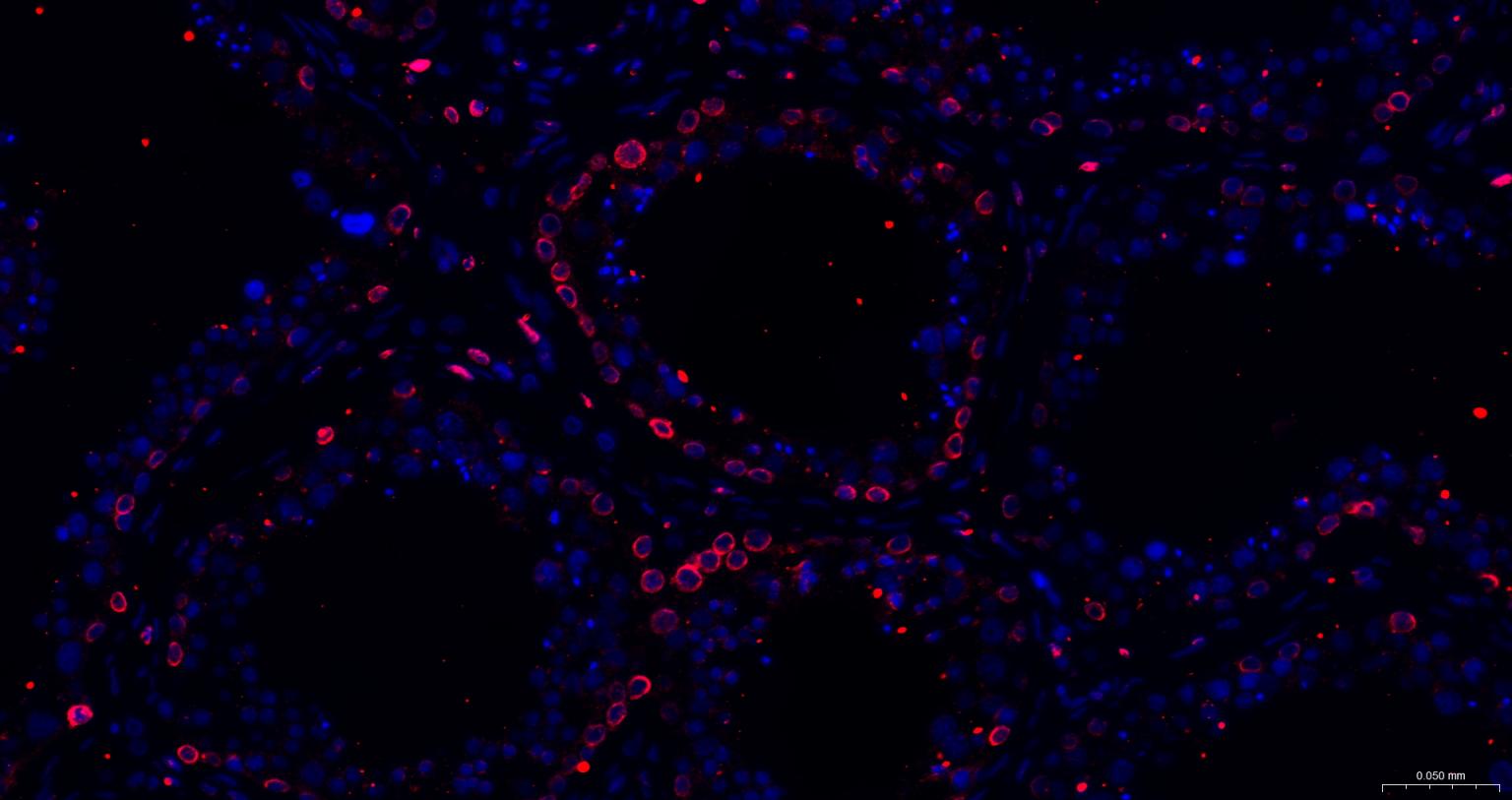 核纤层蛋白B重组兔单抗