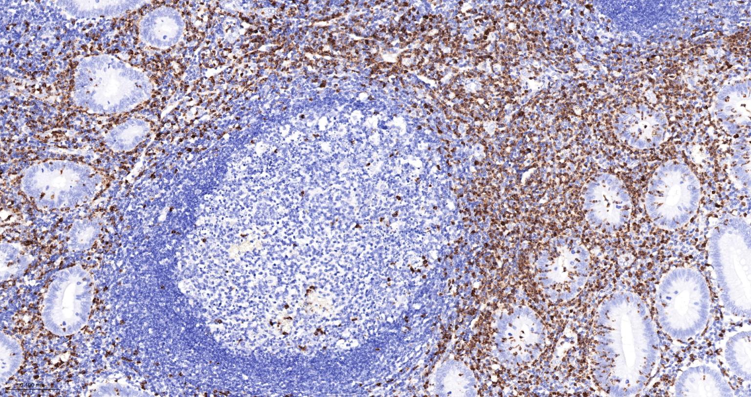 髓过氧化物酶重组兔单抗