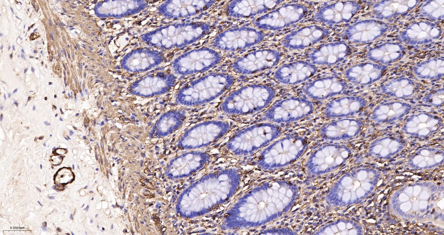 肌动蛋白α/α-SMA/α Actin单克隆抗体-bsm-33187M