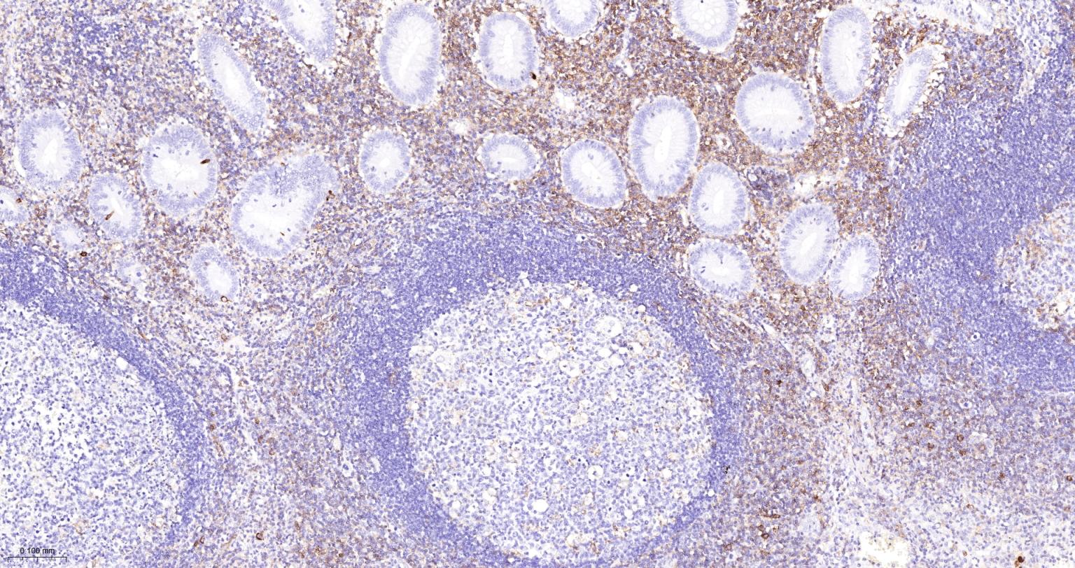 P选择素糖蛋白配体1重组兔单抗
