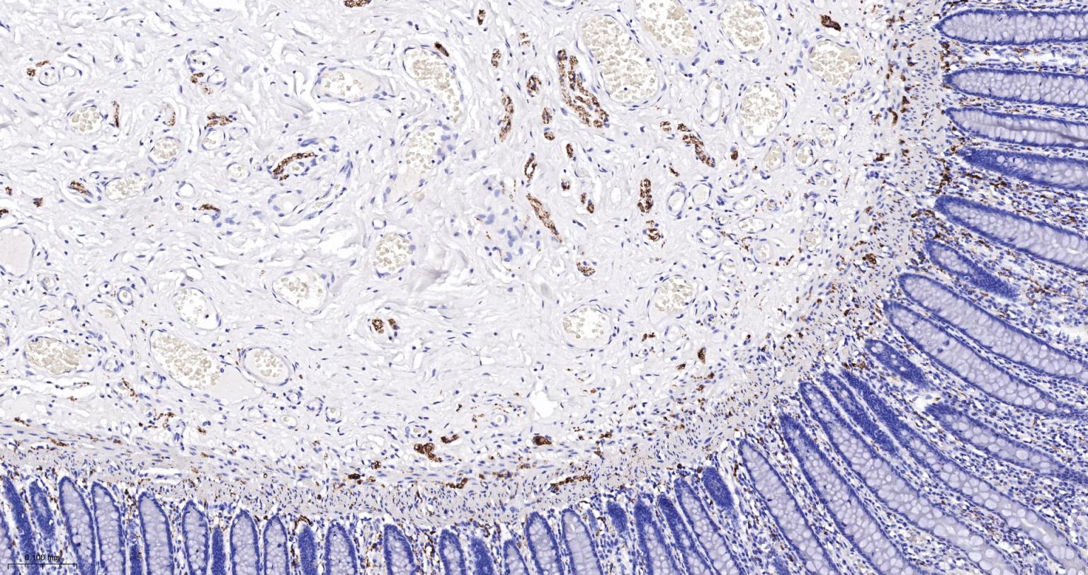 神经细胞胞浆蛋白9.5重组兔单抗