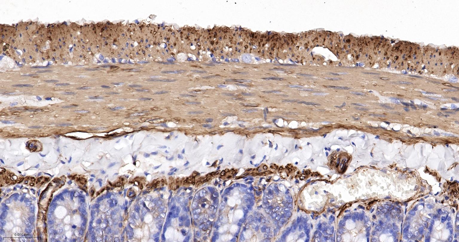 肌动蛋白α/α-SMA/α Actin单克隆抗体-bsm-33187M