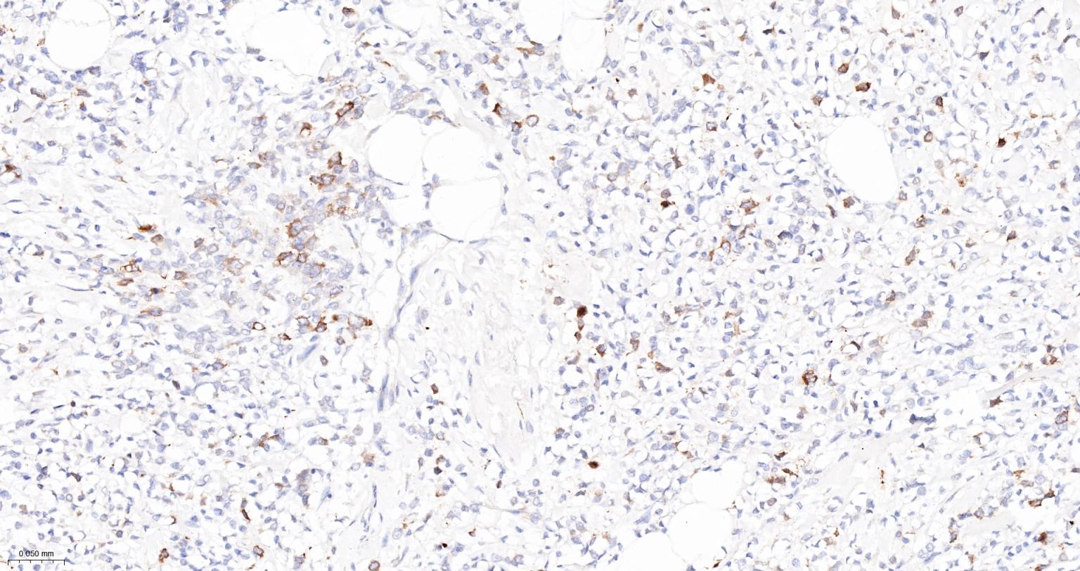 TACC3重组兔单抗