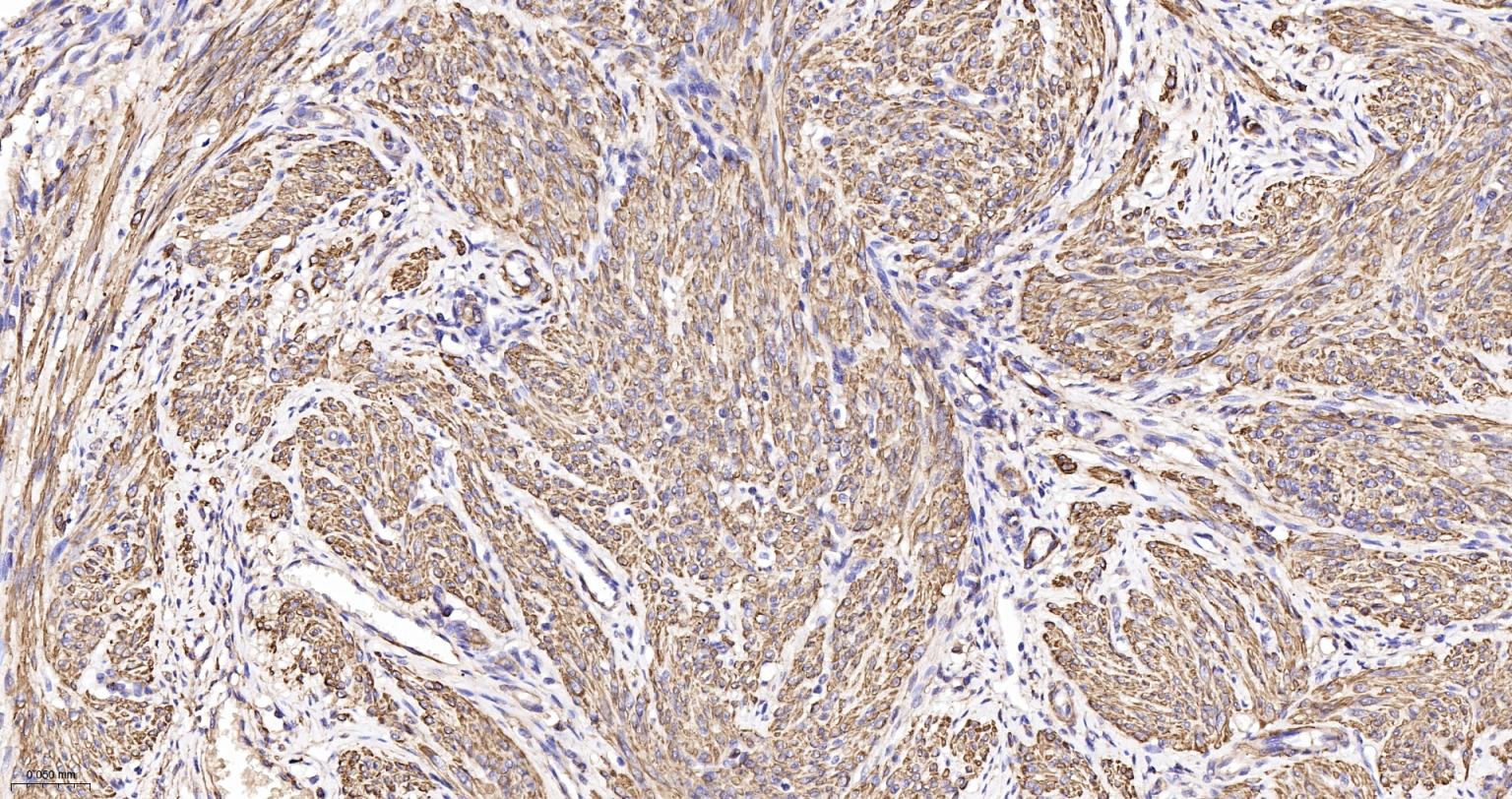 肌动蛋白α/α-SMA/α Actin单克隆抗体-bsm-33187M