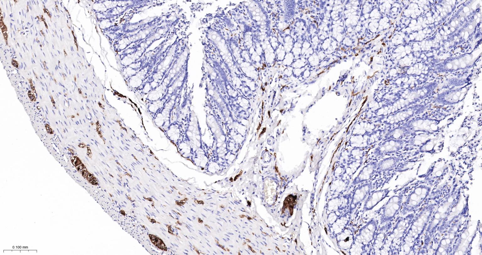 神经细胞胞浆蛋白9.5重组兔单抗