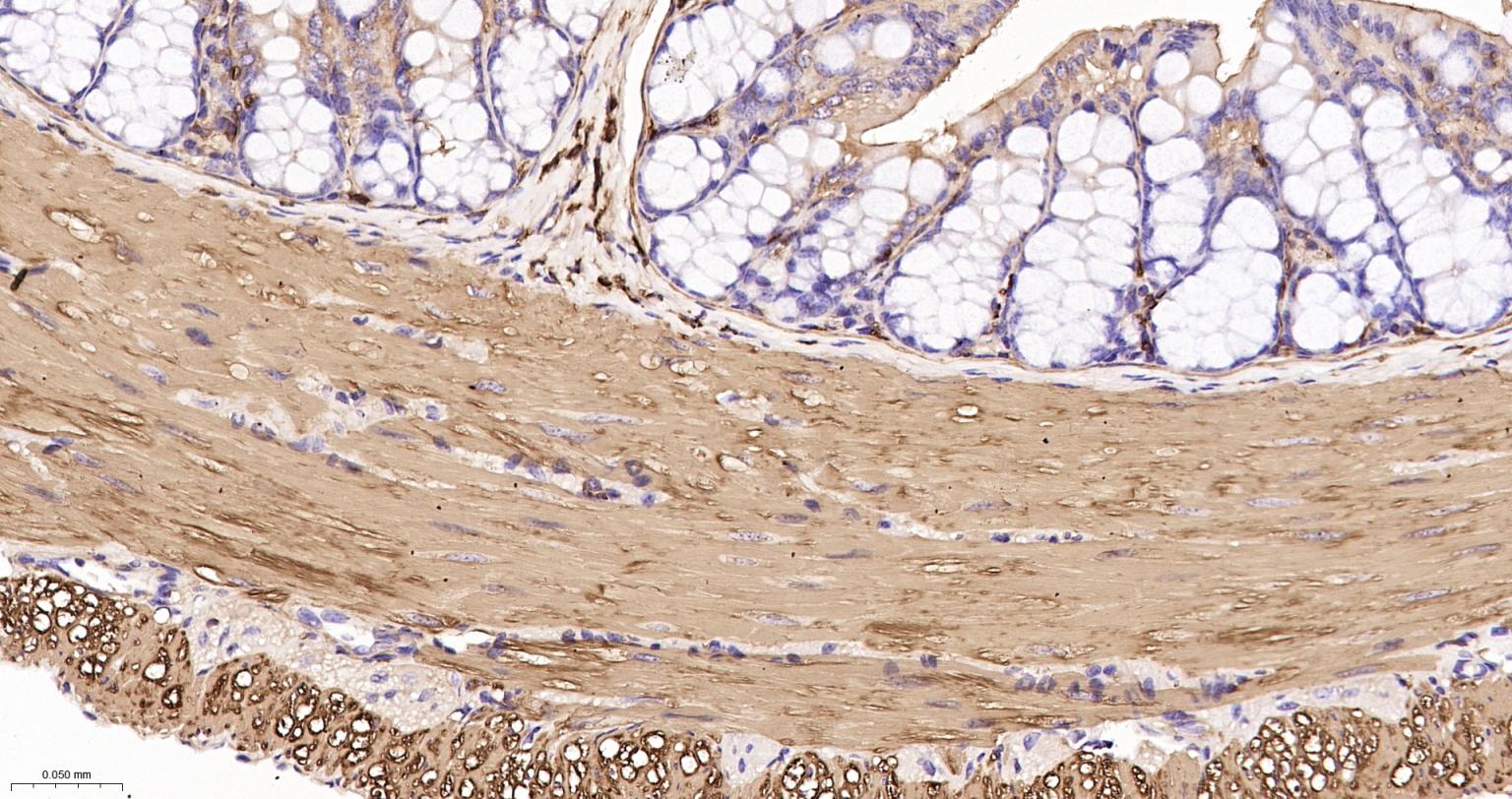 肌动蛋白α/α-SMA/α Actin单克隆抗体-bsm-33187M