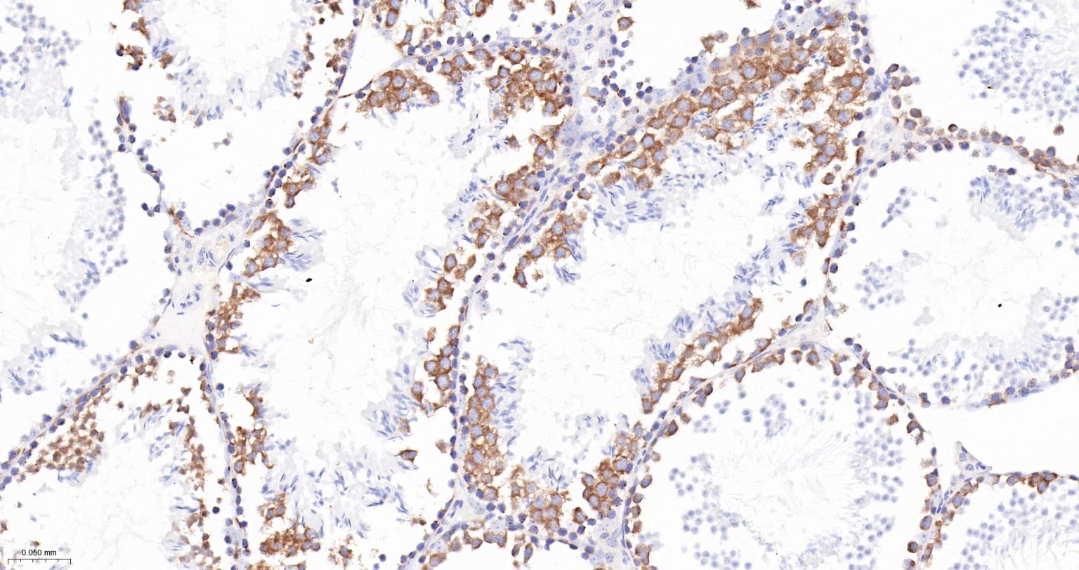 TACC3重组兔单抗