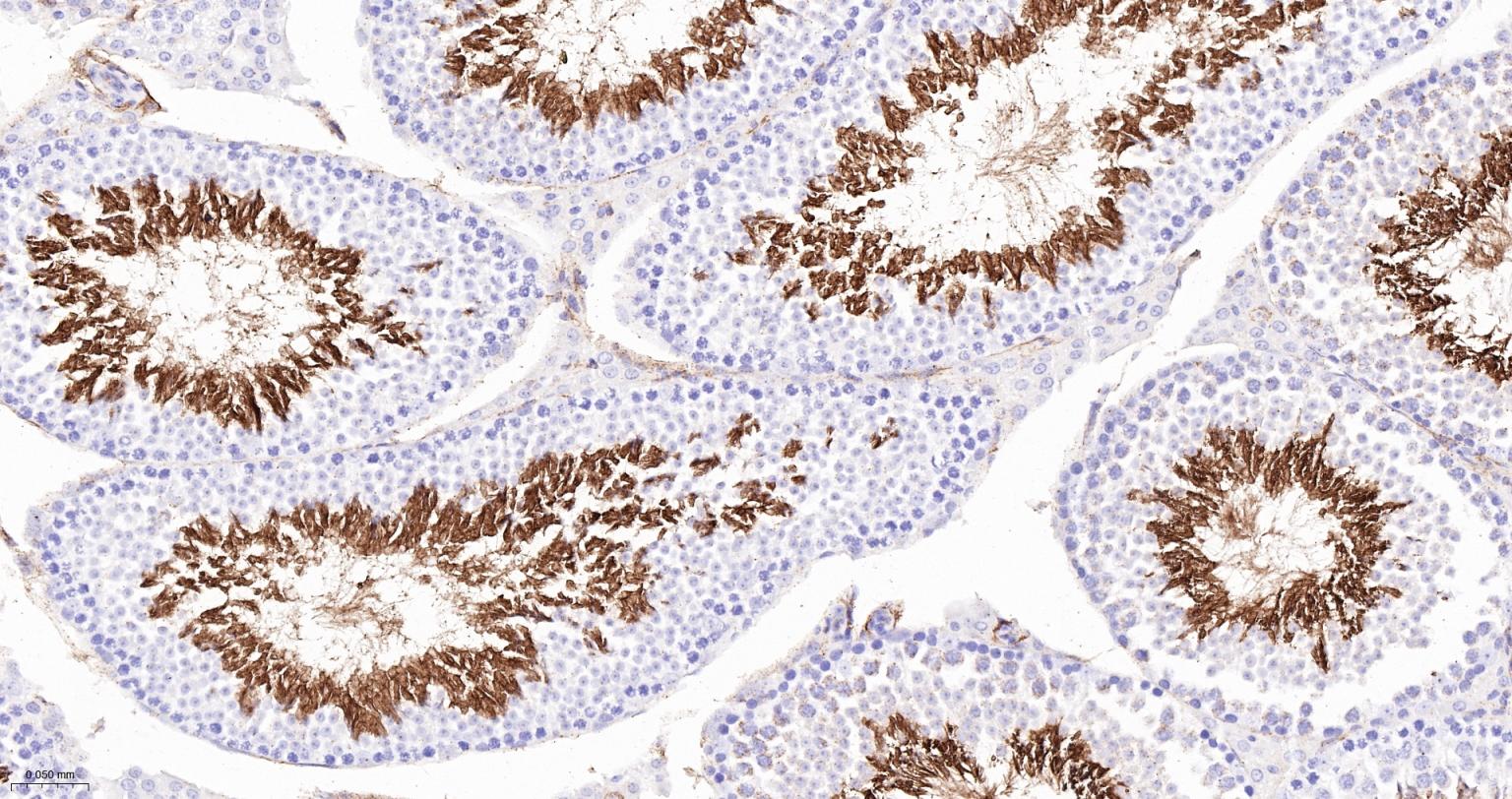 血管紧张素转换酶ACE1重组兔单抗