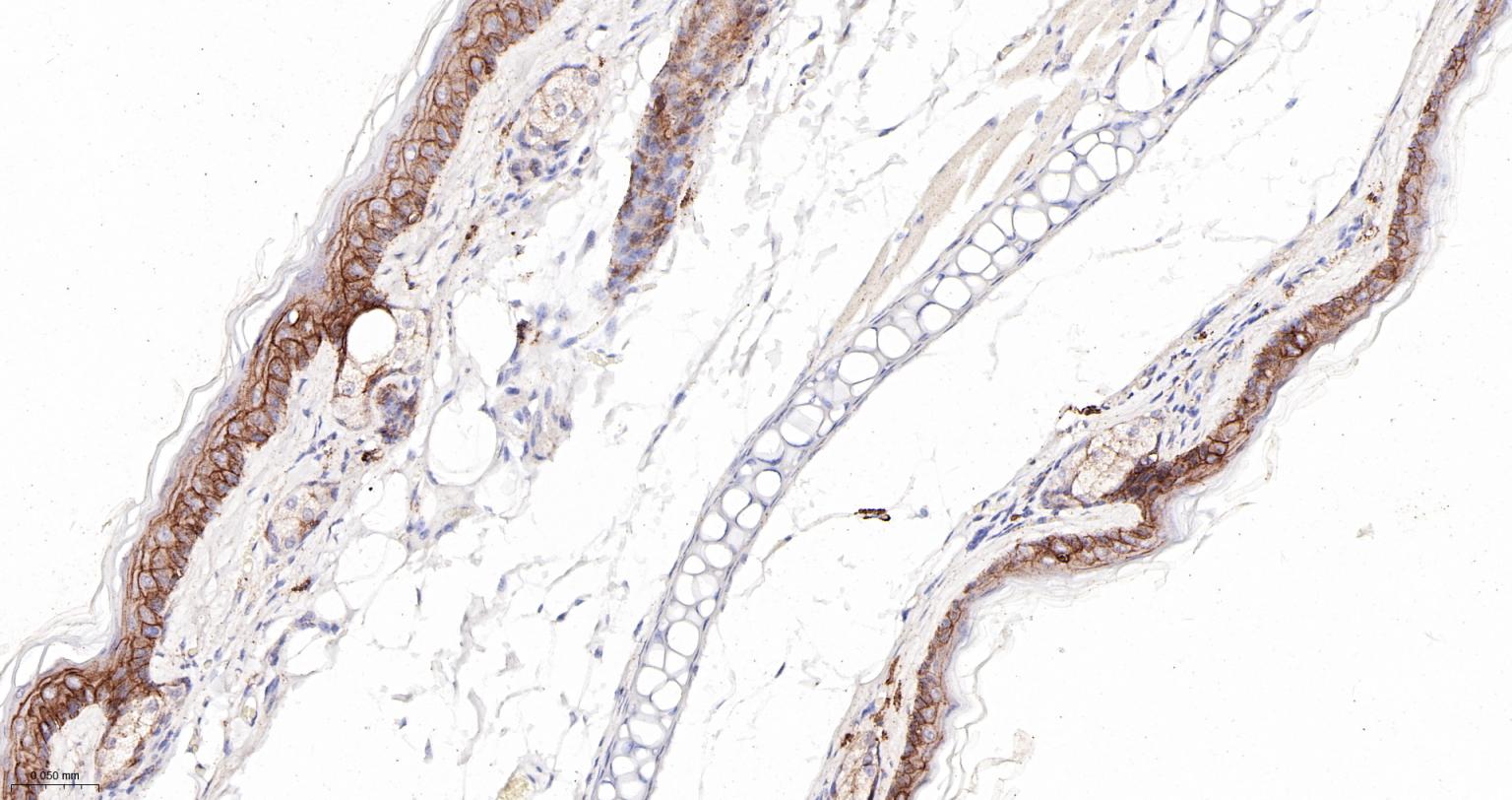 连环蛋白delta-1重组兔单抗