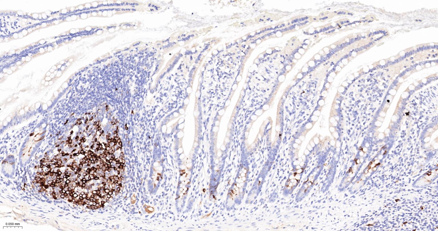 TACC3重组兔单抗