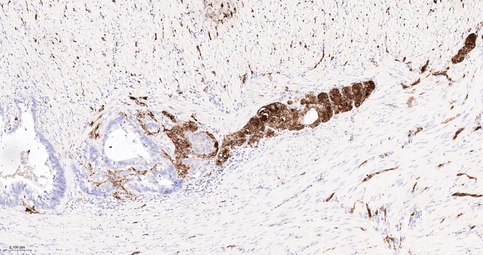 神经细胞胞浆蛋白9.5重组兔单抗