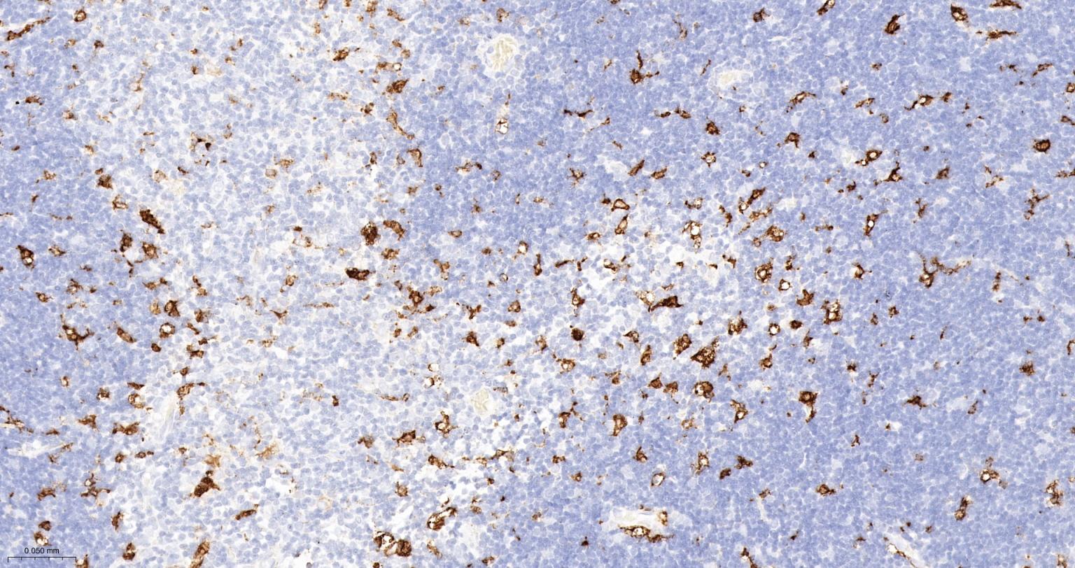 血红素氧合酶 1抗体