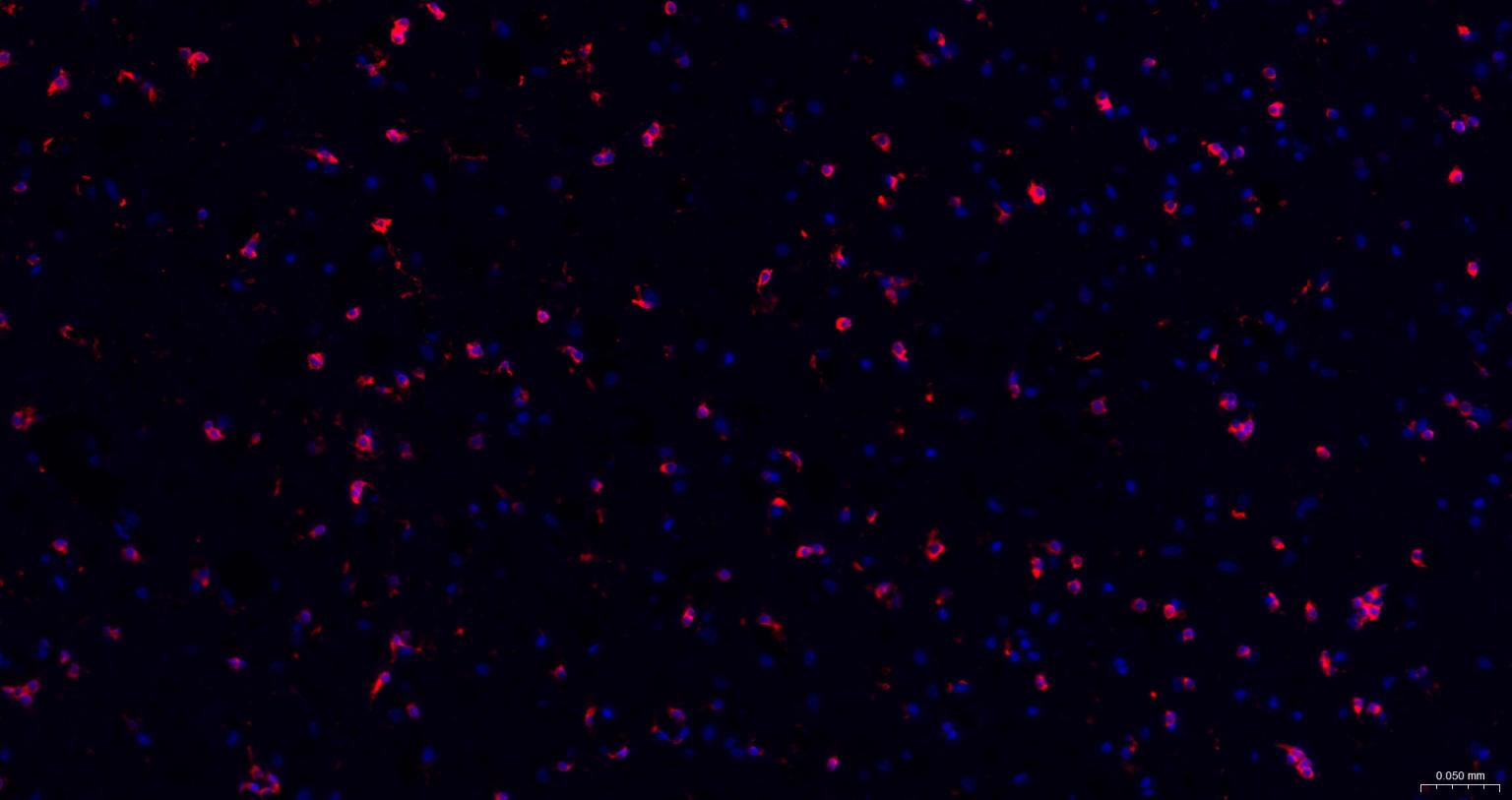 离子型谷氨酸受体1重组兔单抗