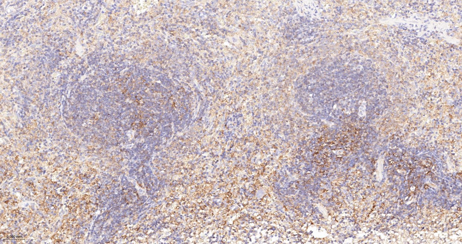 5-三磷酸肌醇受体1重组兔单抗