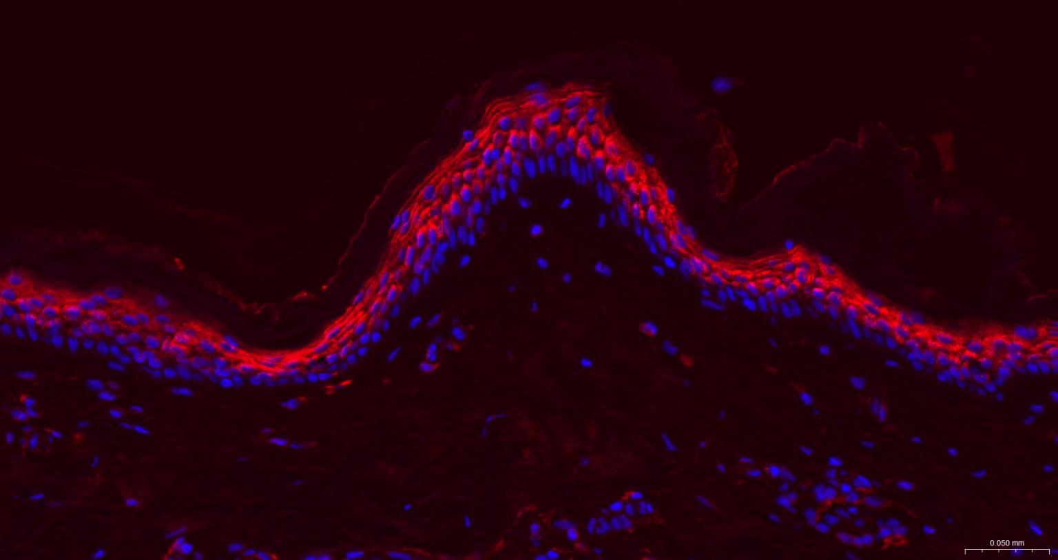 载脂蛋白E重组兔单抗