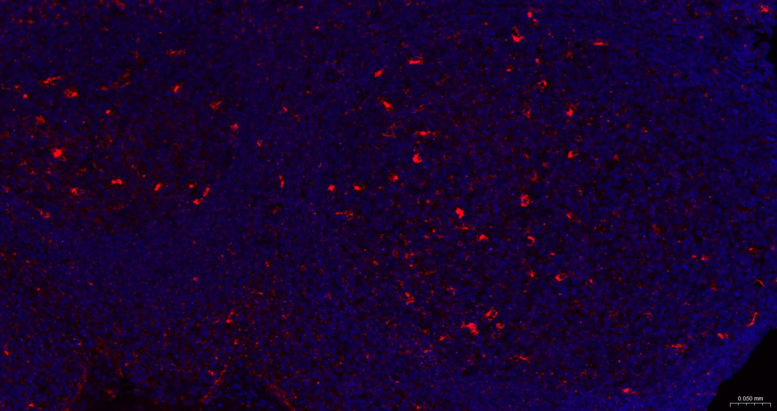 载脂蛋白E重组兔单抗