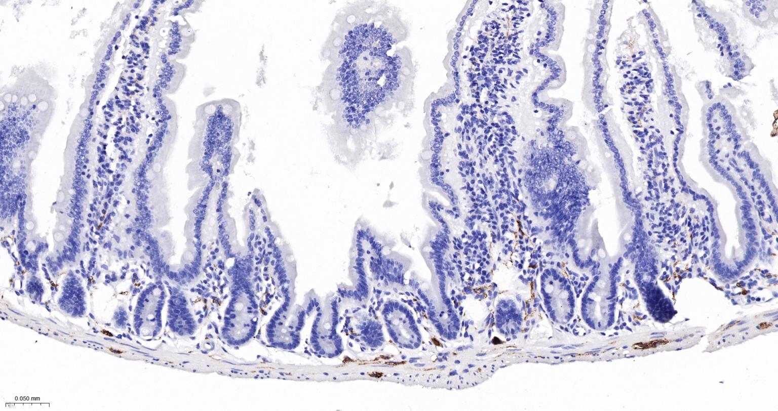 神经细胞胞浆蛋白9.5重组兔单抗