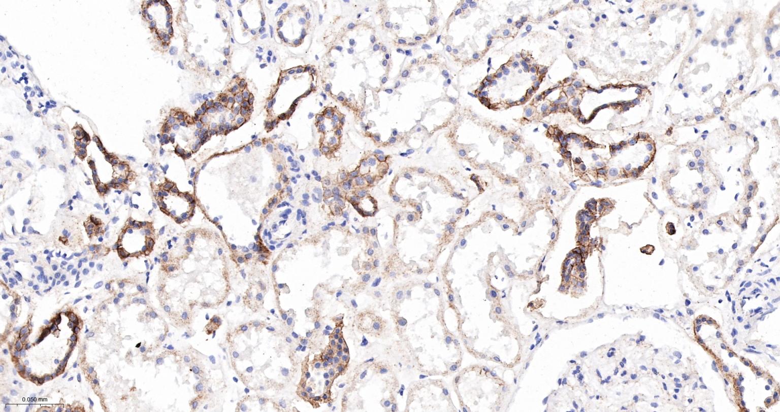 连环蛋白delta-1重组兔单抗
