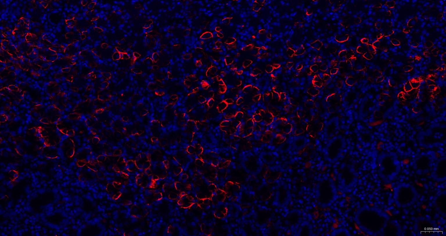 水通道蛋白4重组兔单抗