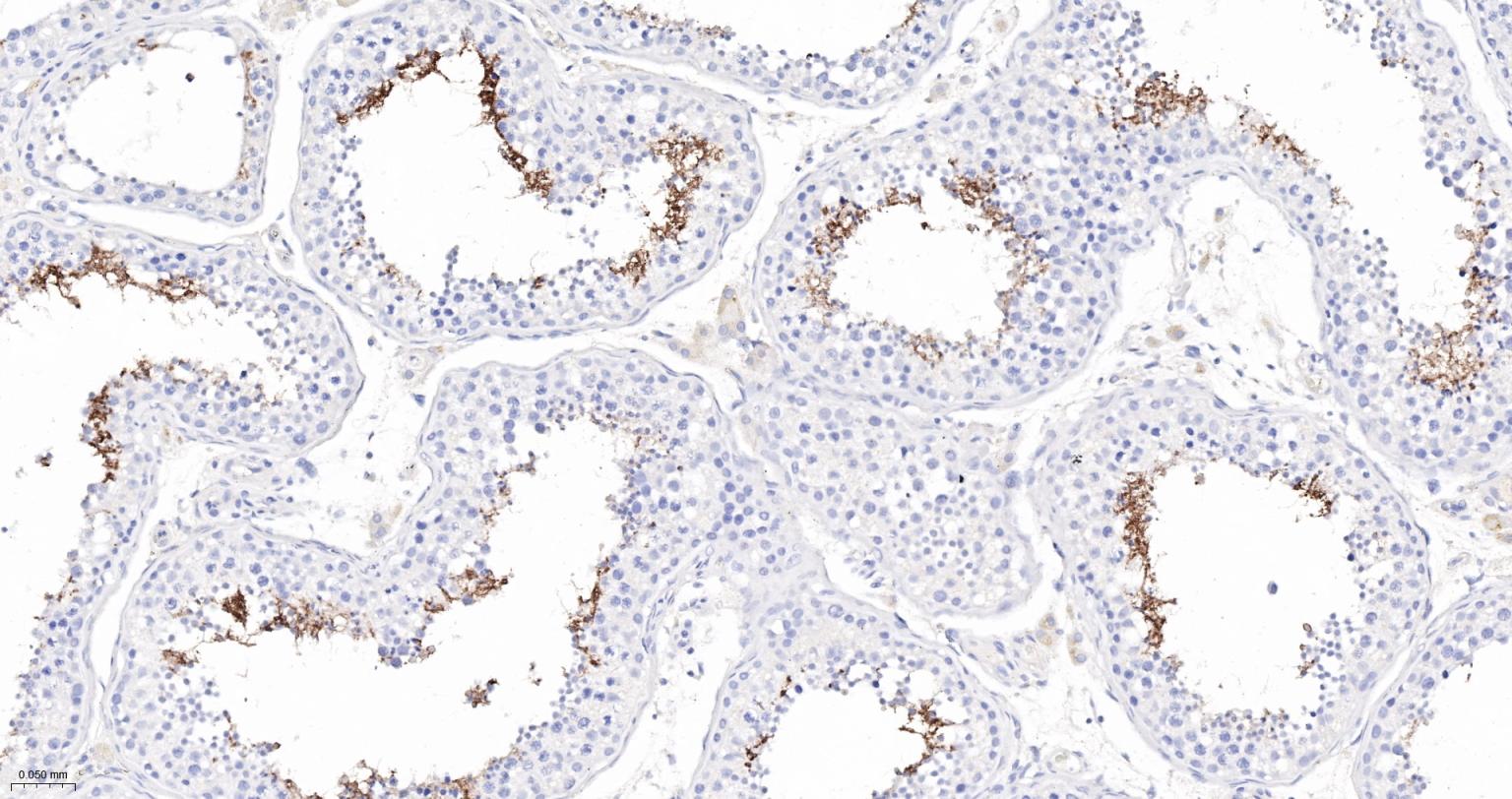 血管紧张素转换酶ACE1重组兔单抗