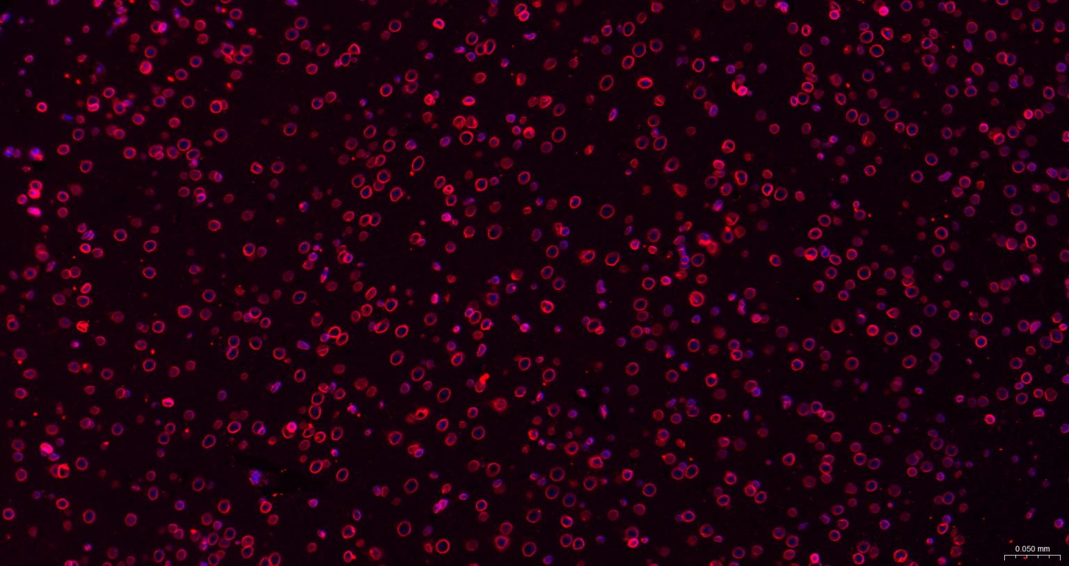 核纤层蛋白B重组兔单抗