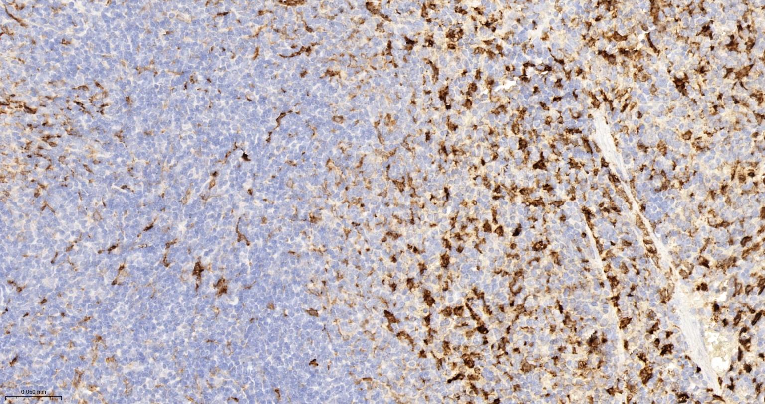 血红素氧合酶 1抗体