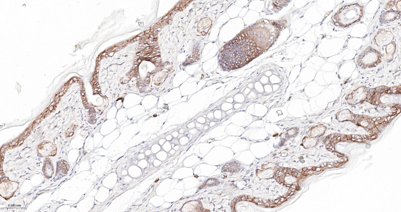 连环蛋白delta-1重组兔单抗