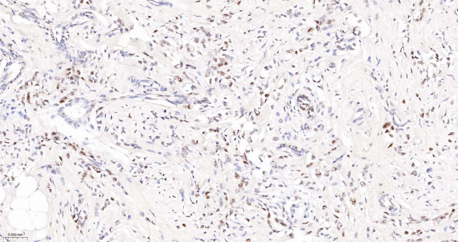 磷酸化信号转导和转录激活因子3单克隆抗体-bsm-33301M