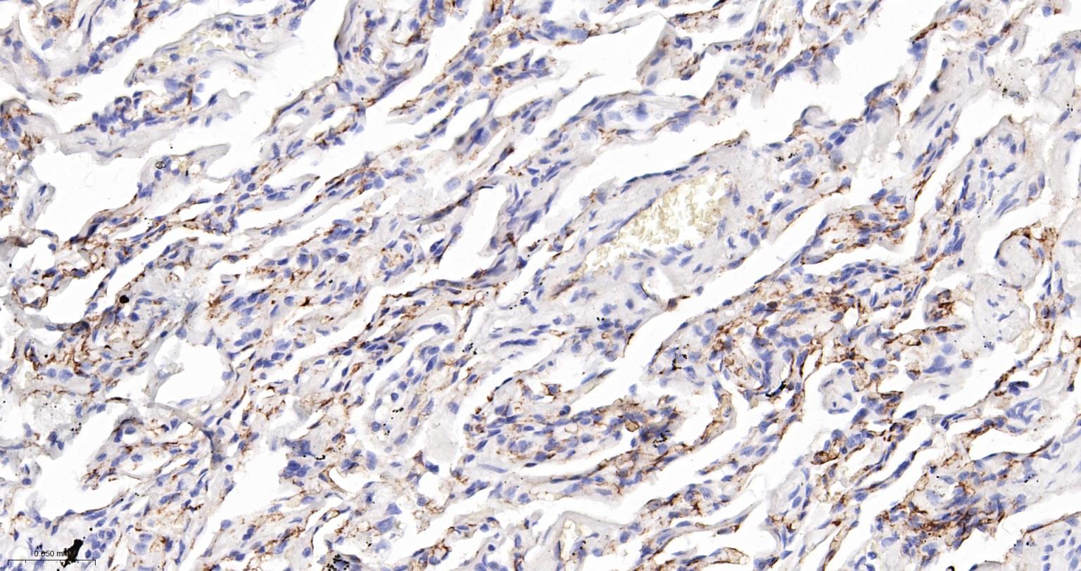 血管紧张素转换酶ACE1重组兔单抗