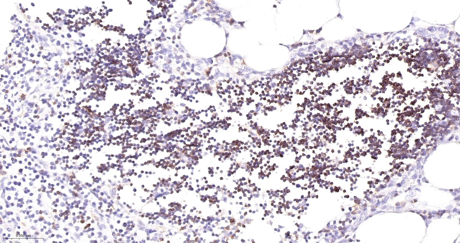 CD8A单克隆抗体-bsm-34251M