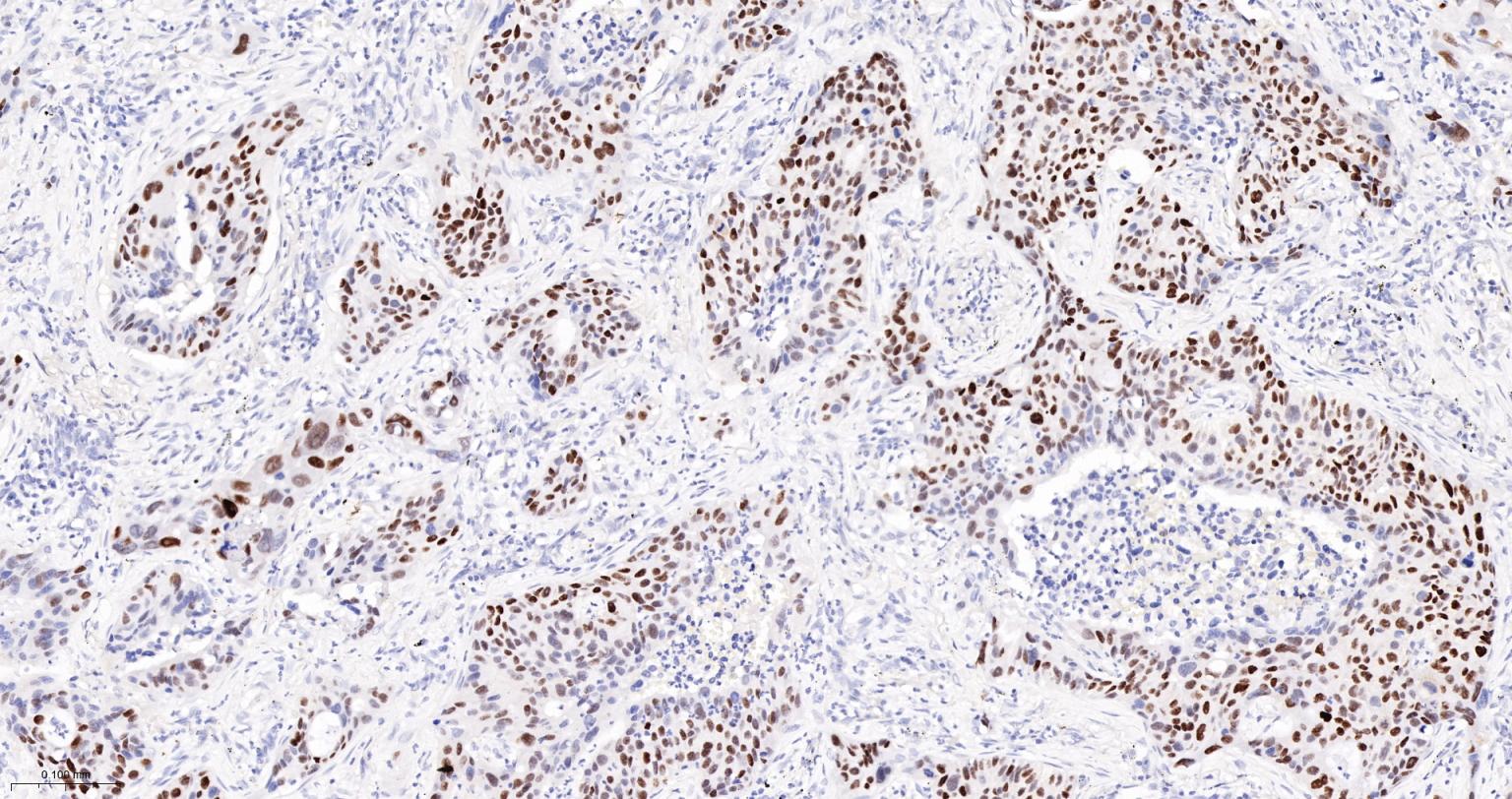 细胞肿瘤抗原P53重组兔单抗