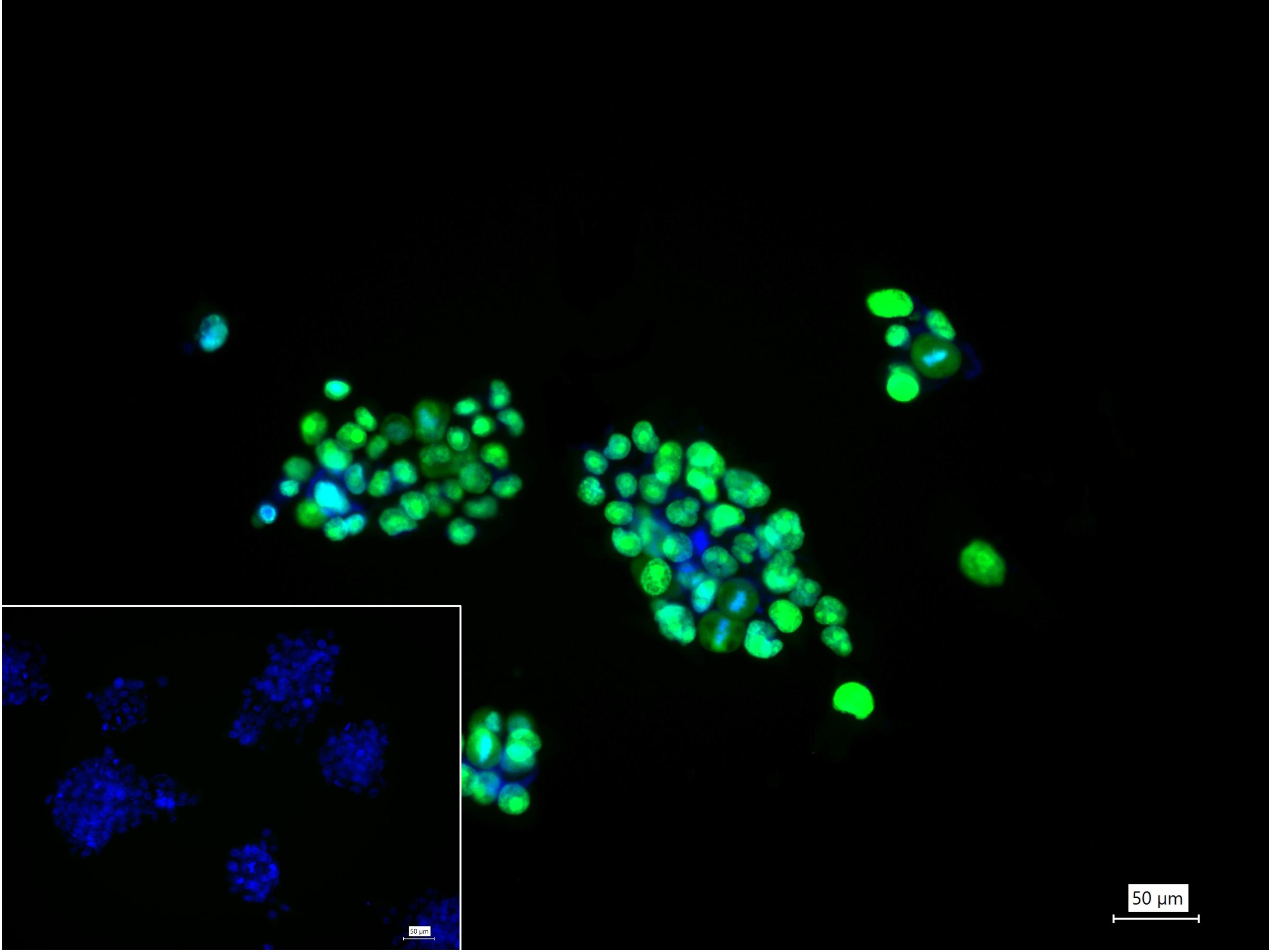 高迁移率族蛋白A1重组兔单抗