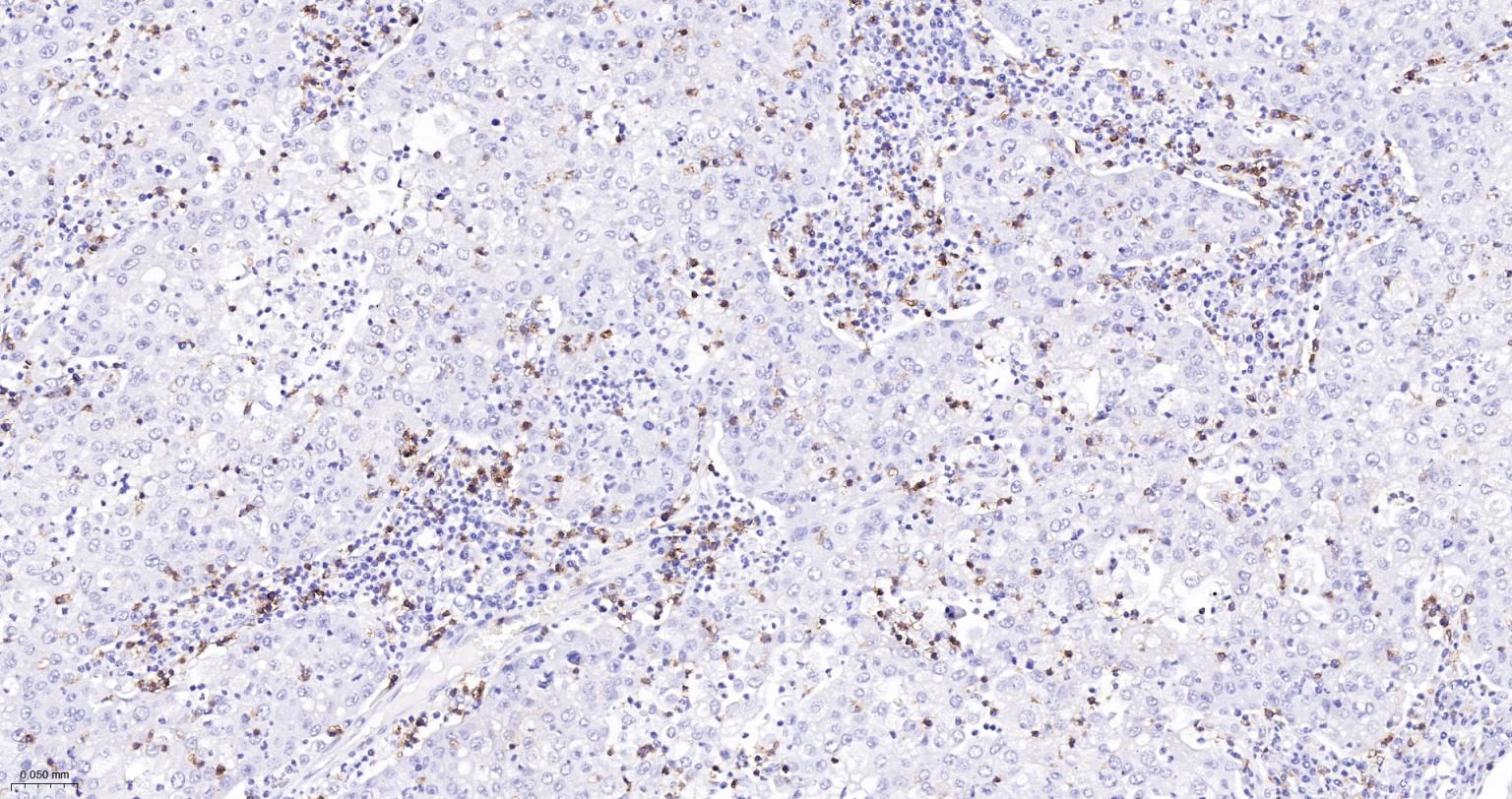 CD8A单克隆抗体-bsm-34251M