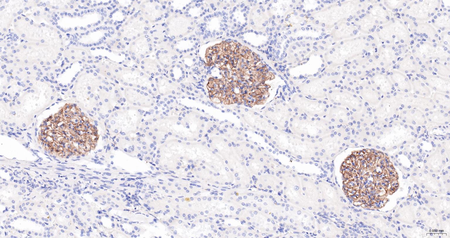 胞质紧密粘连蛋白1/闭锁小带蛋白1单克隆抗体