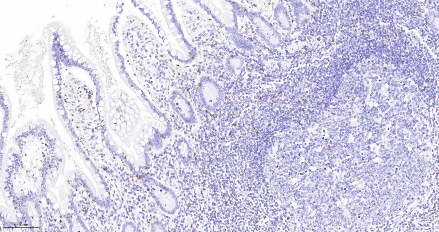 CD8A单克隆抗体-bsm-34251M