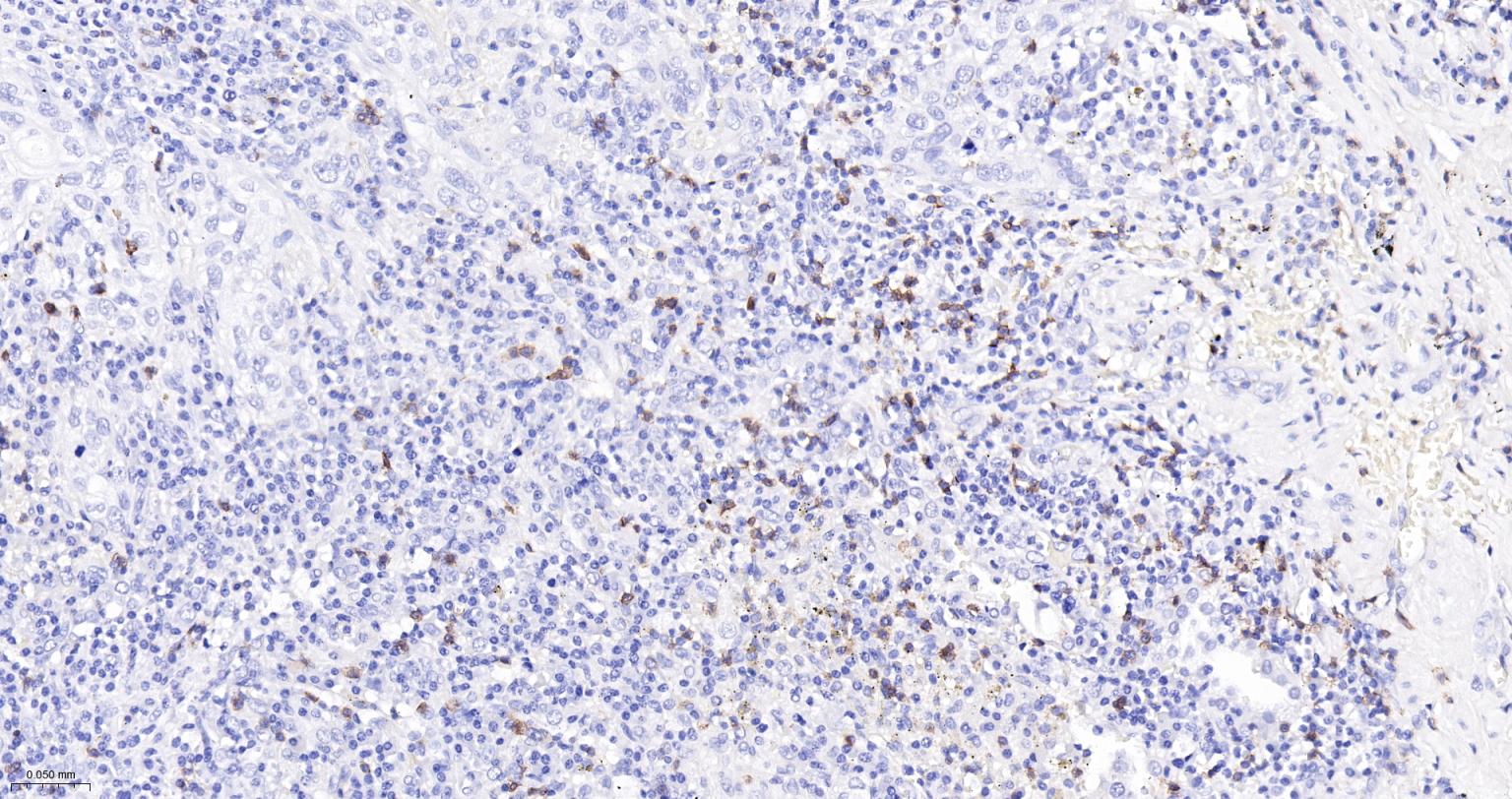 CD8A单克隆抗体-bsm-34251M