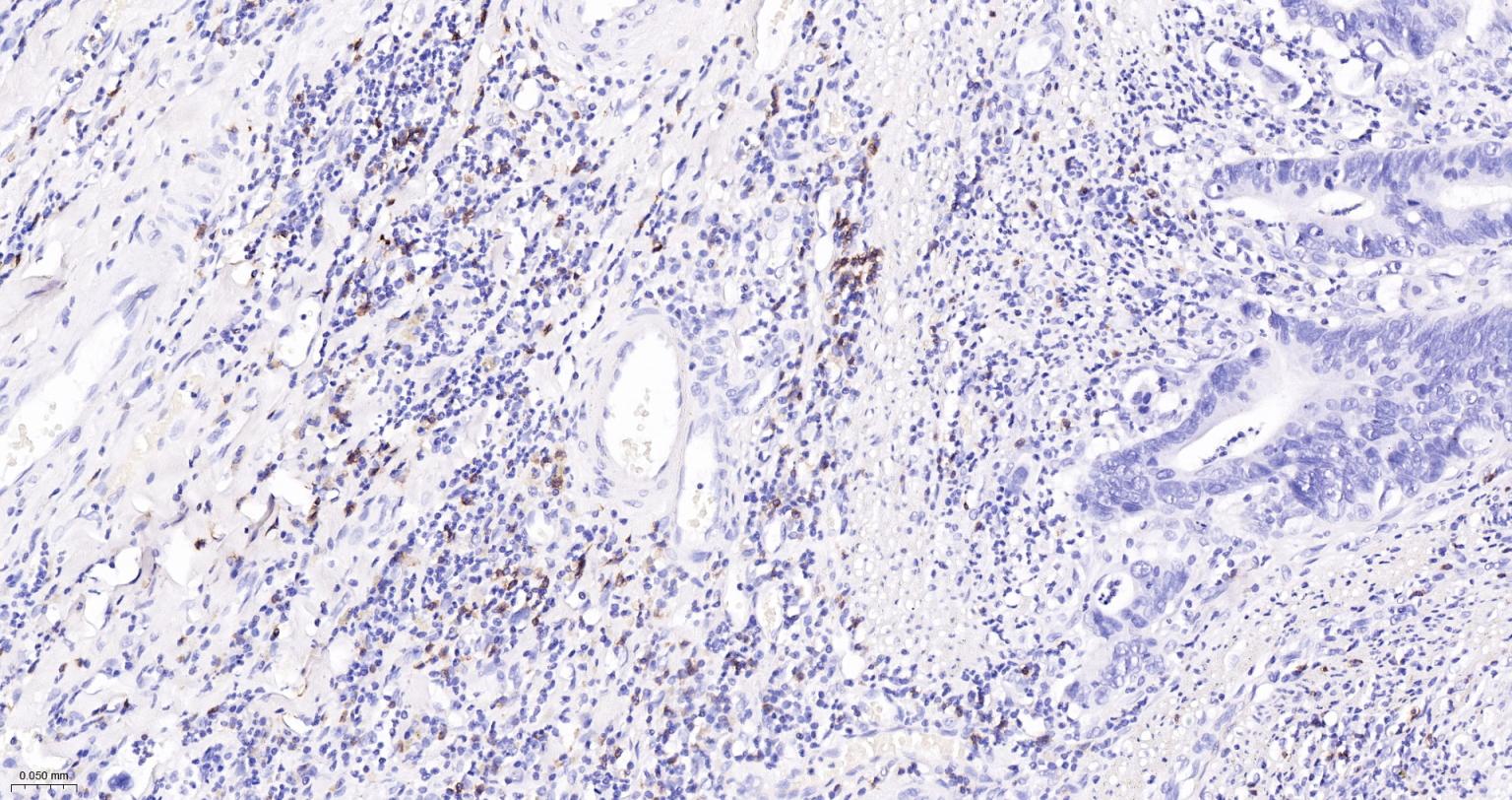 CD8A单克隆抗体-bsm-34251M