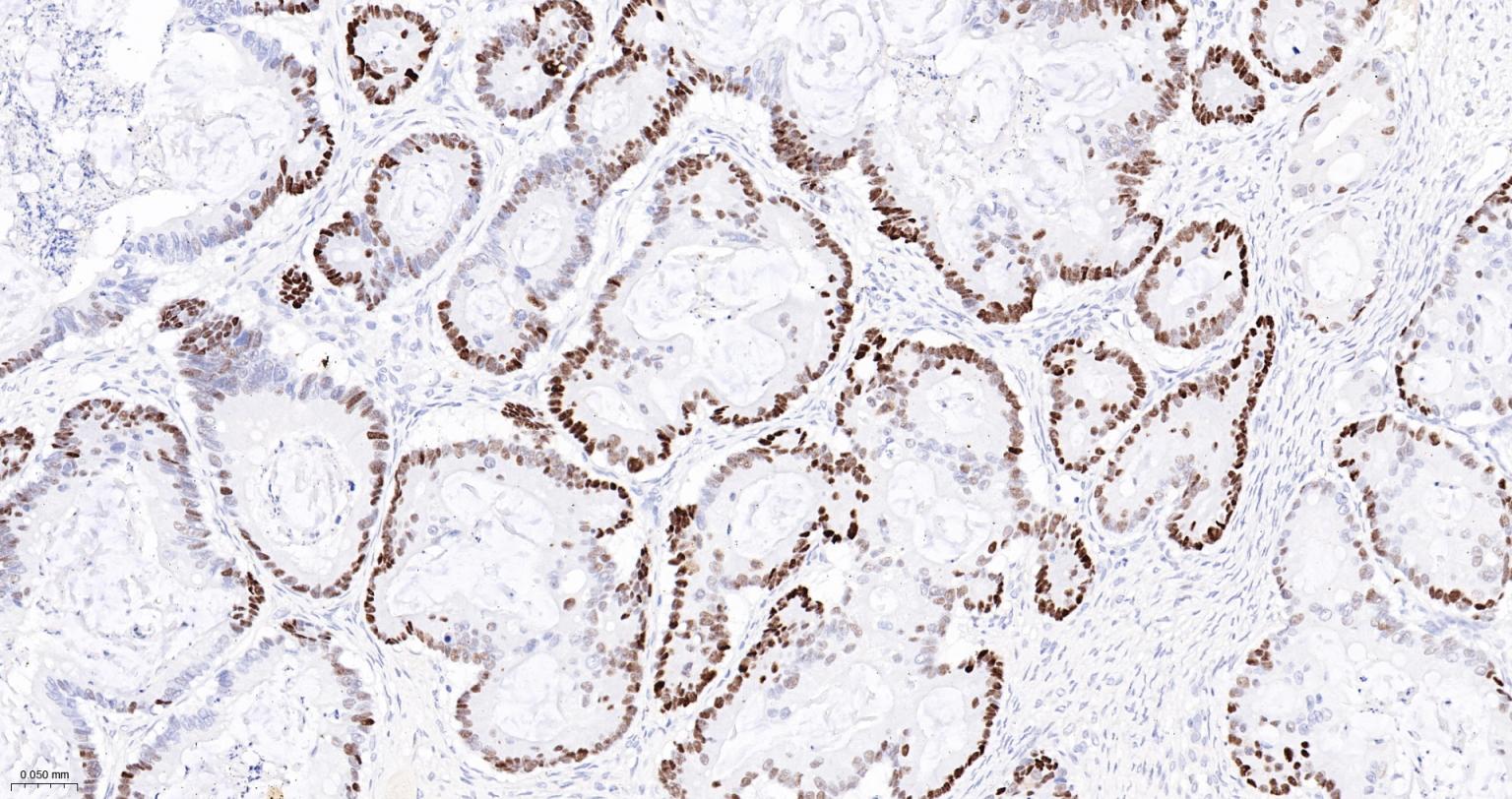 细胞肿瘤抗原P53重组兔单抗
