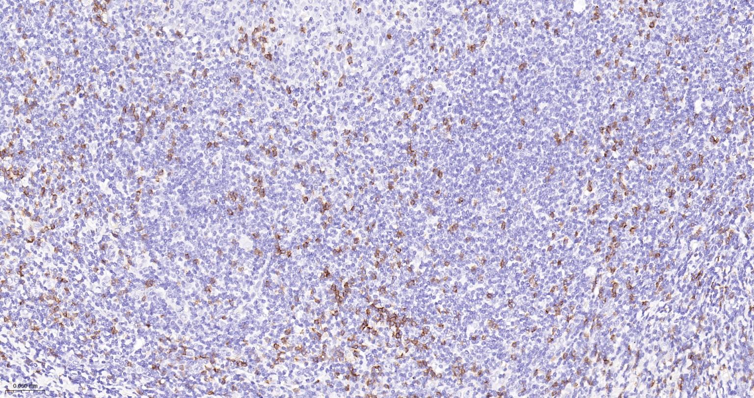 CD8A单克隆抗体-bsm-34251M