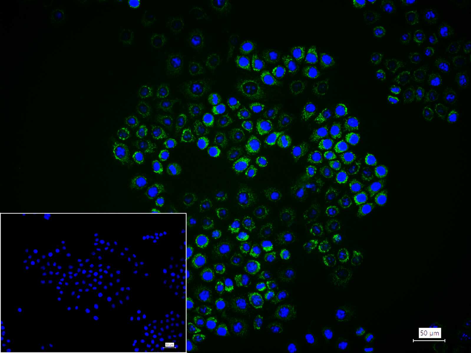 凋亡诱导因子重组兔单抗