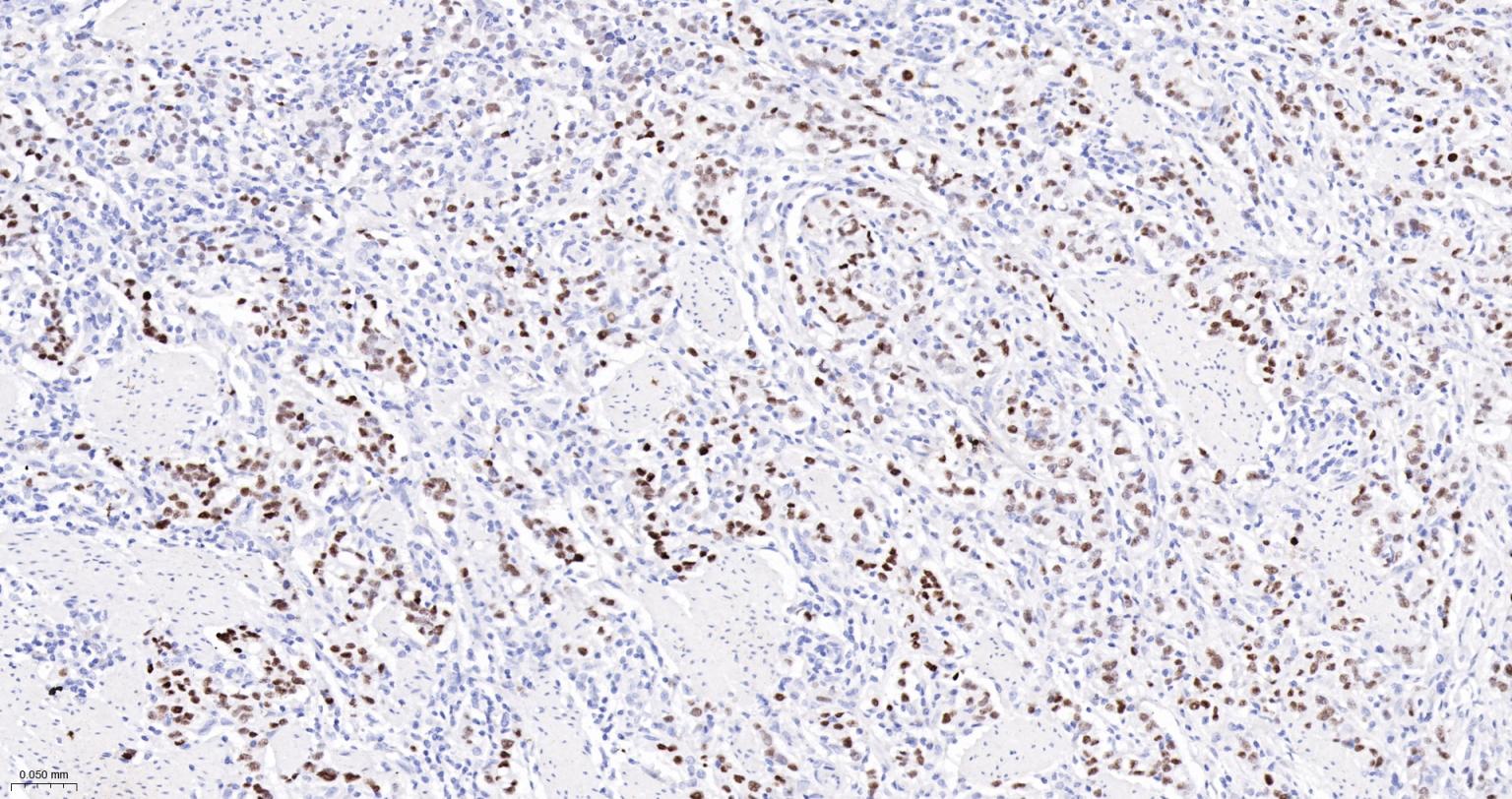 细胞肿瘤抗原P53重组兔单抗