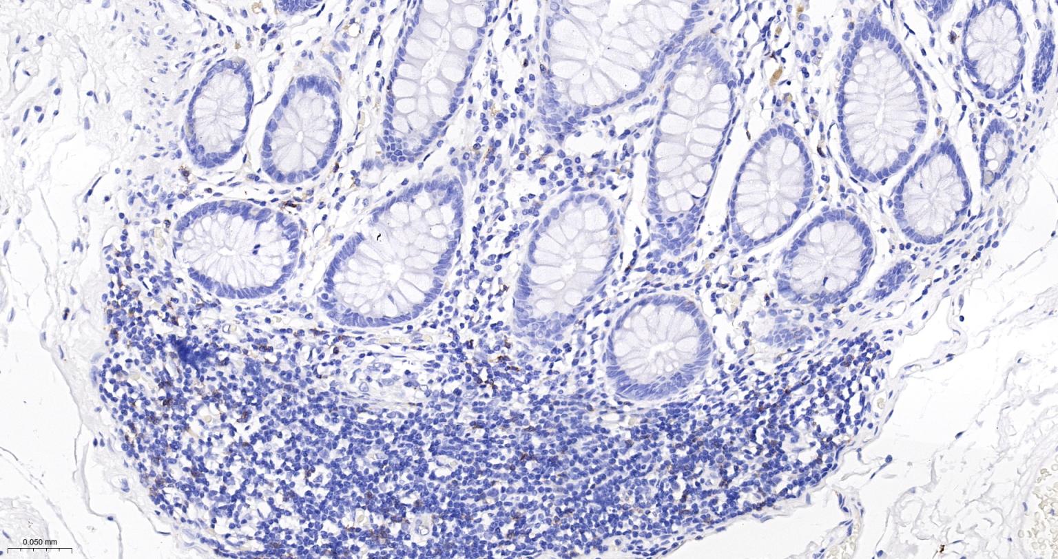 CD8A单克隆抗体-bsm-34251M