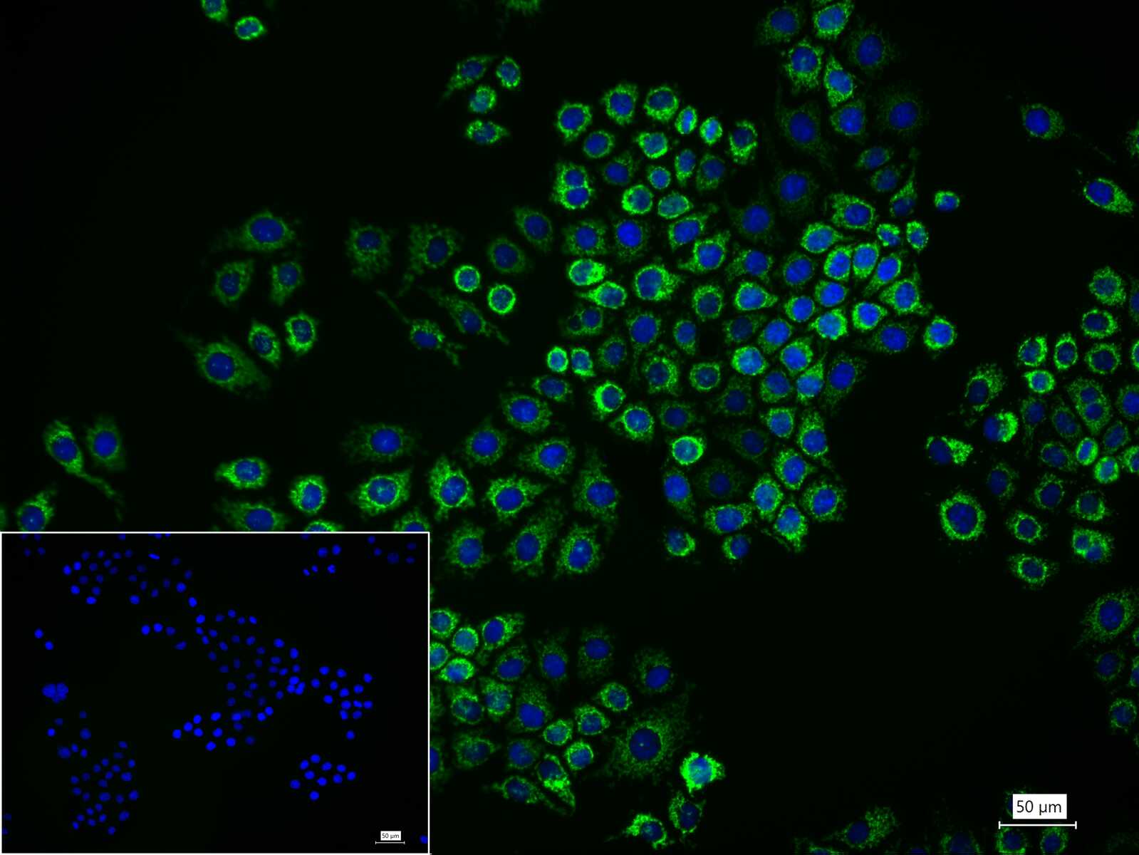 热休克蛋白-60/groEL重组兔单抗